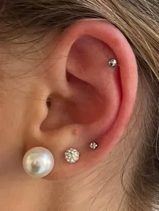 Helix and lobe with a pearl