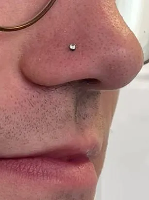 Nostril