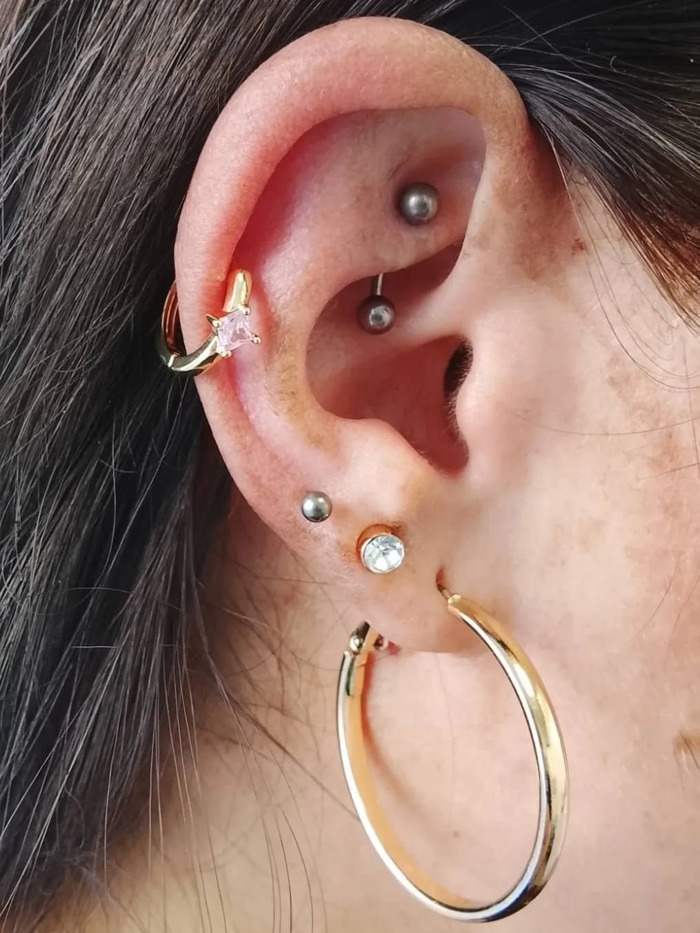 Rook and lobe with rings